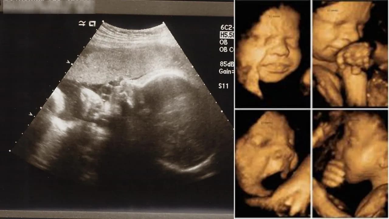 33 tydzień ciąży ból brzucha jak na okres – co może to oznaczać?