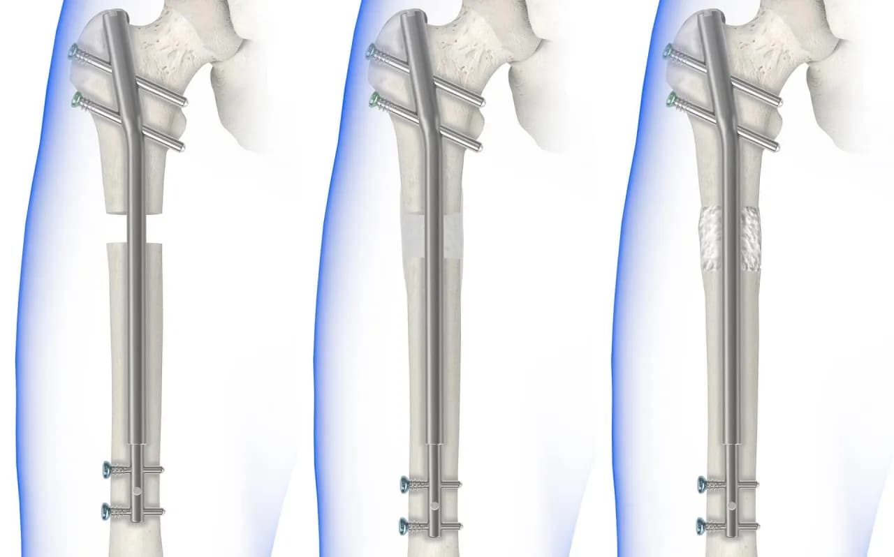Rehabilitacja ud na czym polega: klucz do szybkiego powrotu do zdrowia