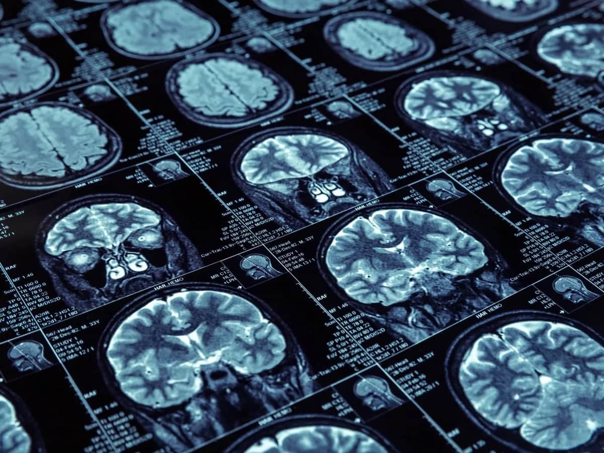 Czy fizjoterapeuta może wystawić skierowanie na rezonans? Oto prawda