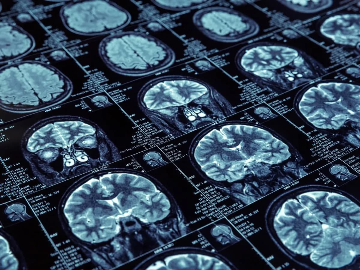 Czy fizjoterapeuta może wystawić skierowanie na rezonans? Oto prawda