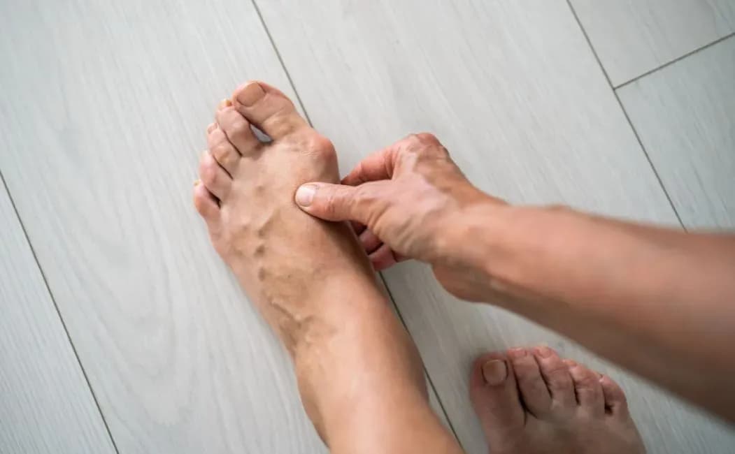 Kiedy ćwiczenia po operacji haluksa? Kluczowe informacje o rehabilitacji