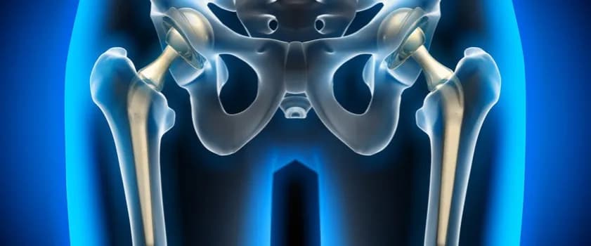Ból stawu biodrowego objawy: Jak rozpoznać i złagodzić dolegliwości