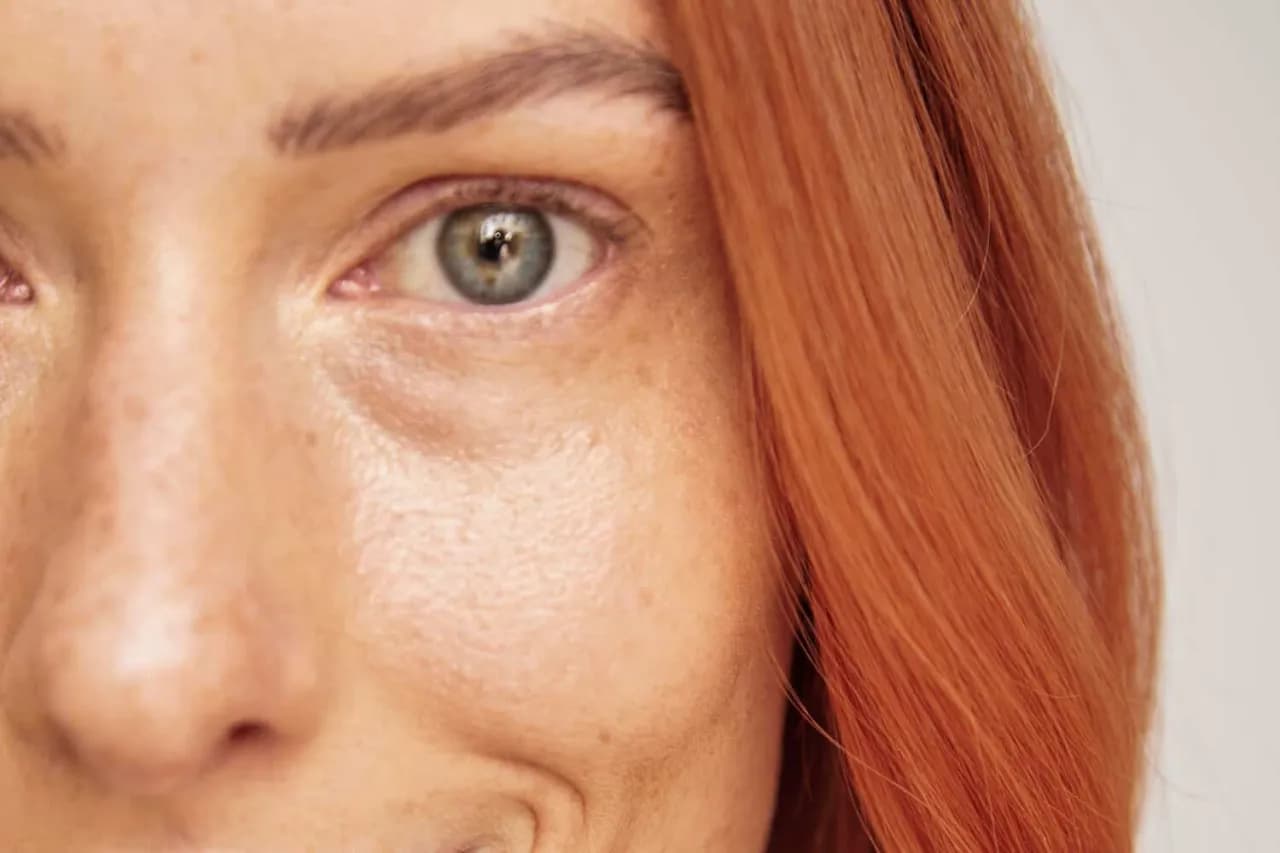 Podkrążone oczy: najczęstsze przyczyny i jak ich unikać