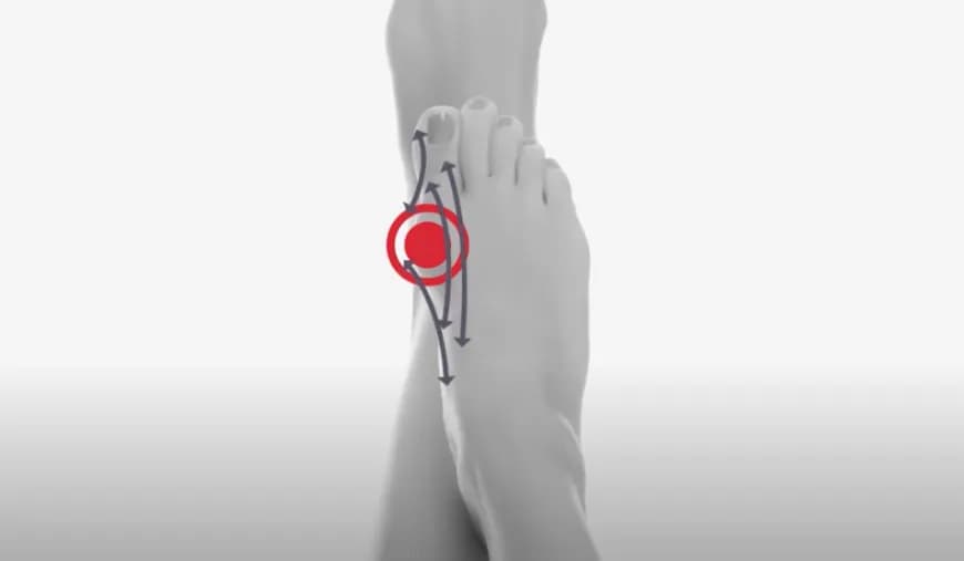 Czy warto operować haluksy? Poznaj korzyści i ryzyko operacji